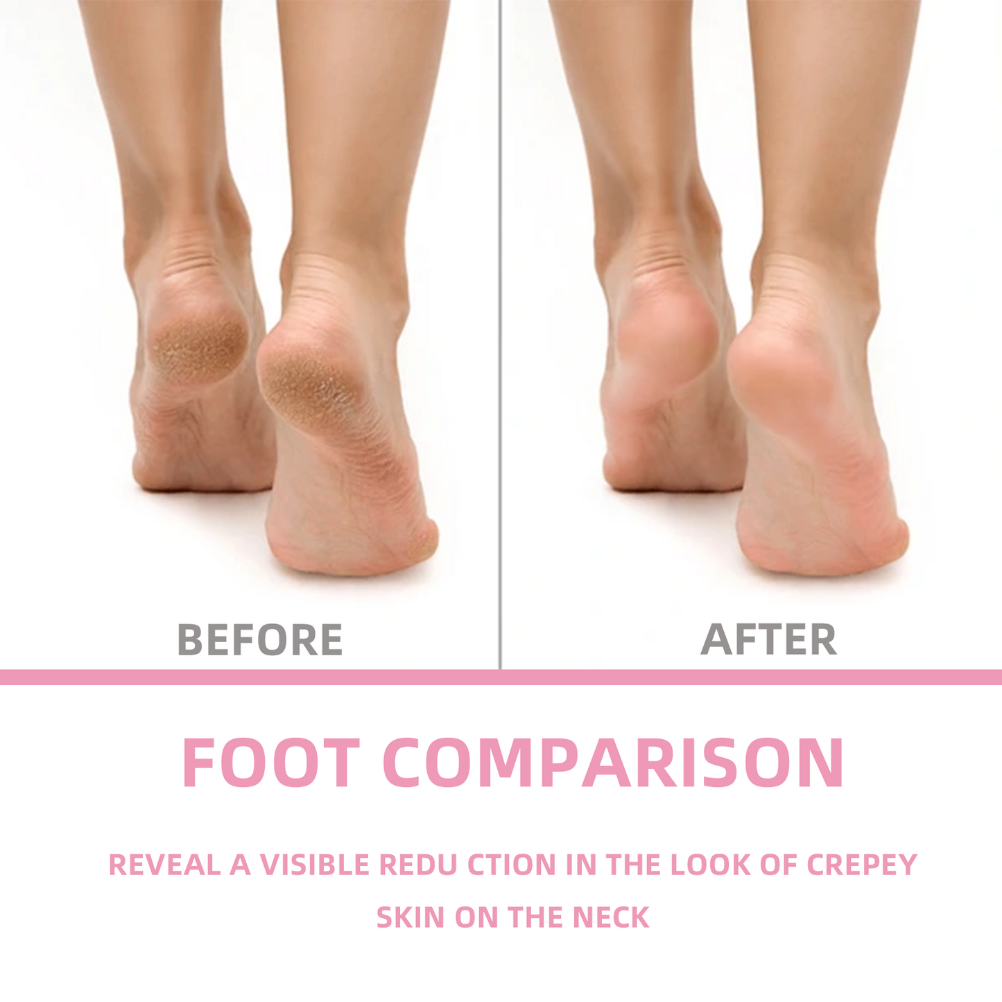 Diana's Dream Foot Cream - Hydrating, Smoothing, and Nourishing Solution for Dry Feet
